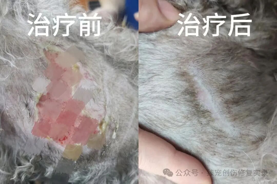 从坏死深坑到新生皮肤，外泌体治疗为伤口创面提供“快、优、净”的修复新选择！