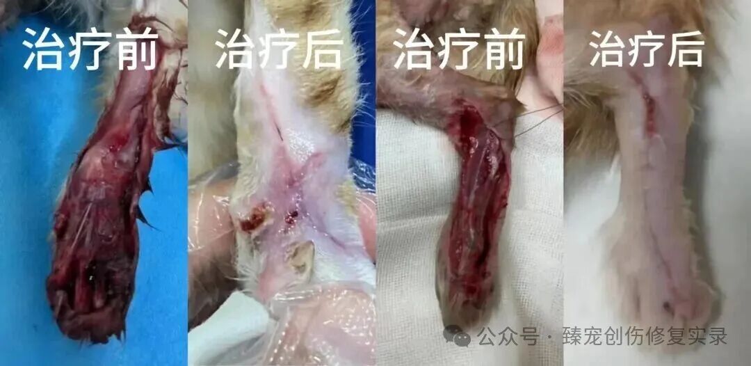 从截肢边缘到完美保肢：外泌体技术仅用21天创造生命奇迹！